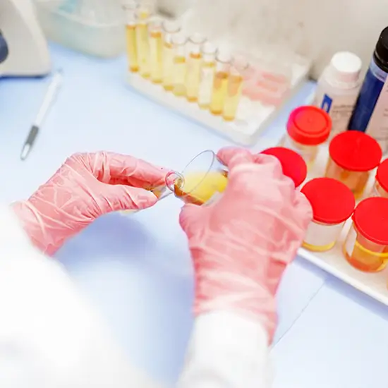 metal screen 3, urine